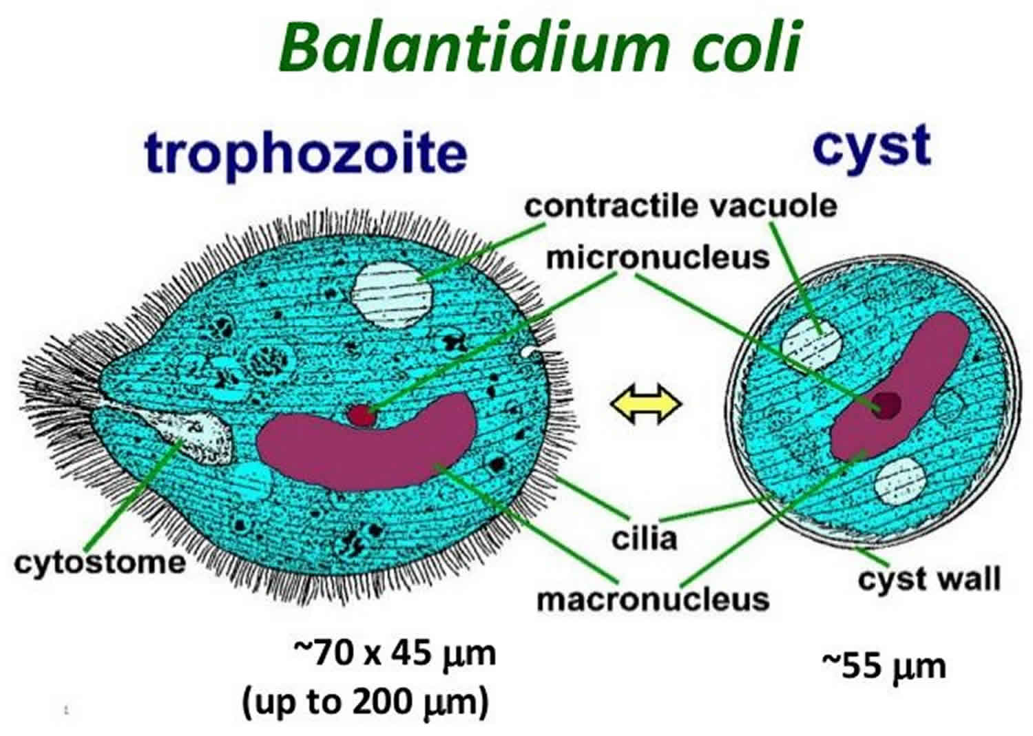 الوصف: Balantidiasis causes, transimission, symptoms, diagnosis & treatment