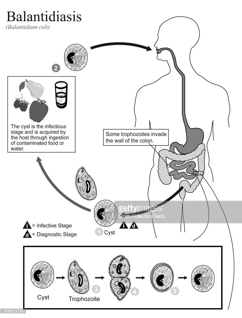 الوصف: Illustrated diagram showing the life cycle of Balantidium coli, the... | Life  cycles, Life, Illustration